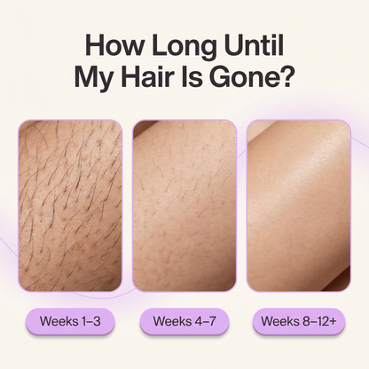 Vella Hair Eliminator
