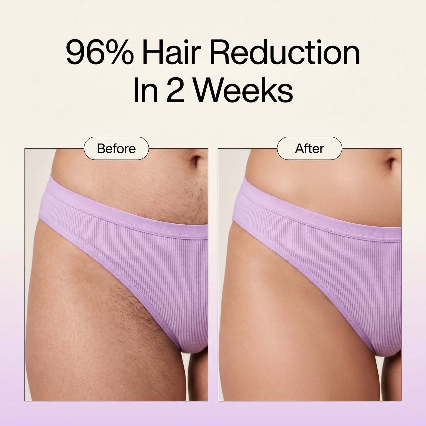 Vella Hair Eliminator