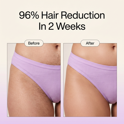 Vella Hair Eliminator