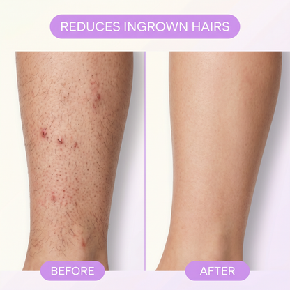 Vella Hair Eliminator
