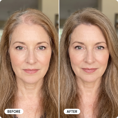 Thicker, Healthier Hair With Vella Hair Growth Elixer