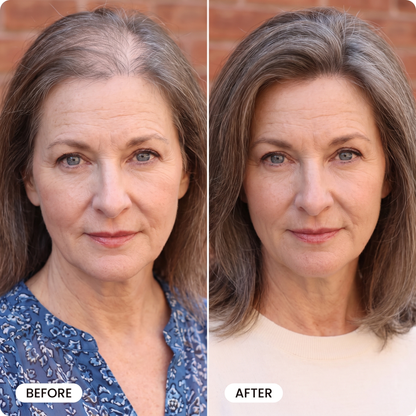 Thicker, Healthier Hair With Vella Hair Growth Elixer